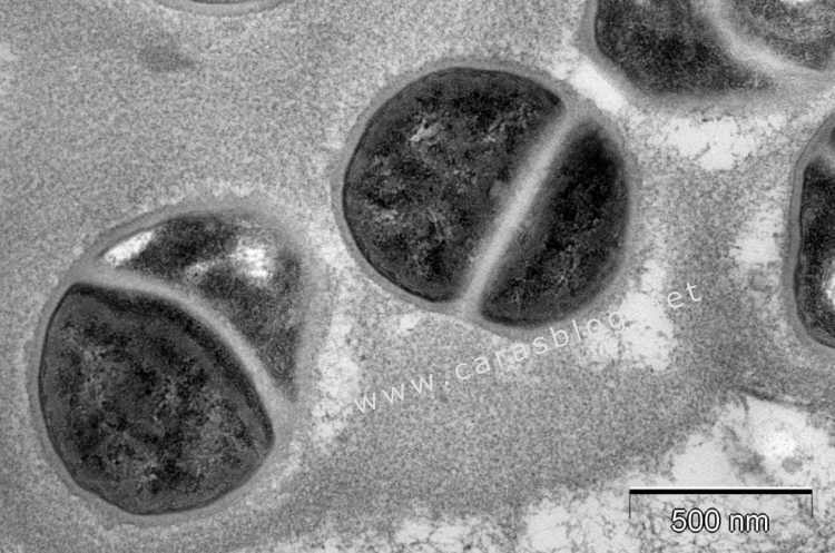 カラスのフンに存在する球菌の電子顕微鏡画像