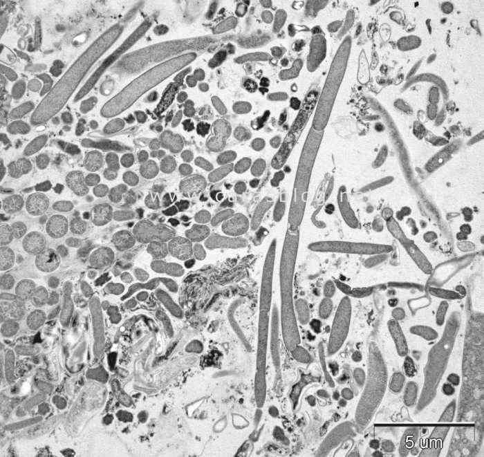 口内細菌の電子顕微鏡画像