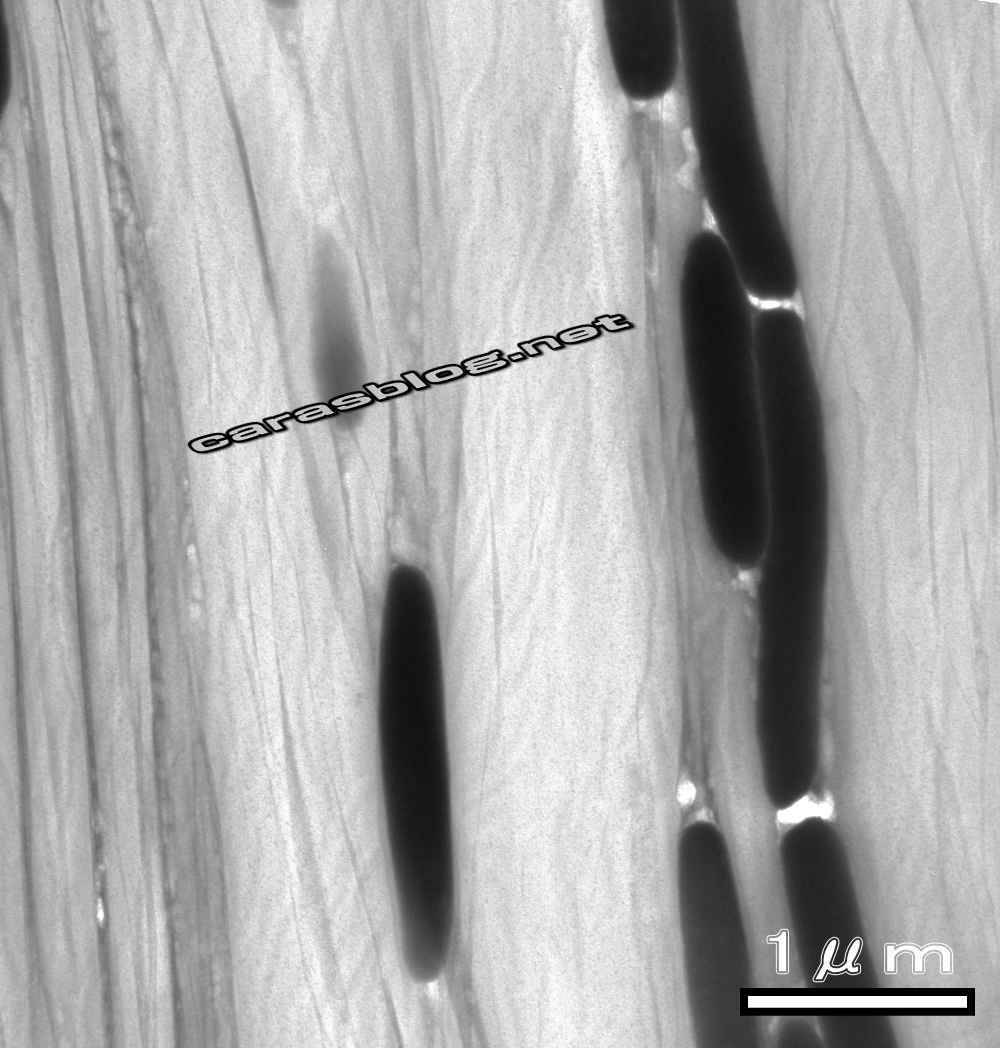 カラスの羽の透過型電子顕微鏡画像